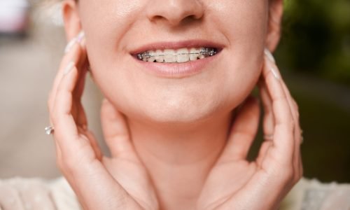 Close up of cheerful young woman with orthodontic brackets on teeth smiling. Patient demonstrating results of dental braces treatment. Concept of dentistry, stomatology and orthodontic treatment.