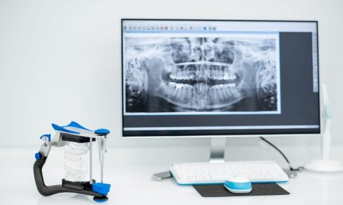 Working place with computer and artificial jaw in the dental office